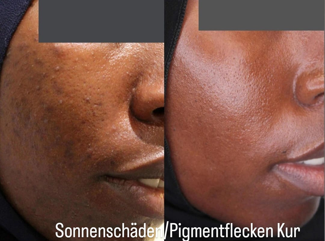 Vorher Nachher 7